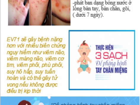 tuyên truyền tay chân miệng tuyên truyền tay chân miệng